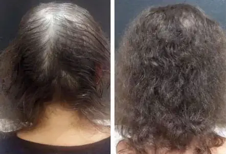 Resultado 2 - Antes e Depois